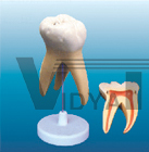 The model of molar resolve